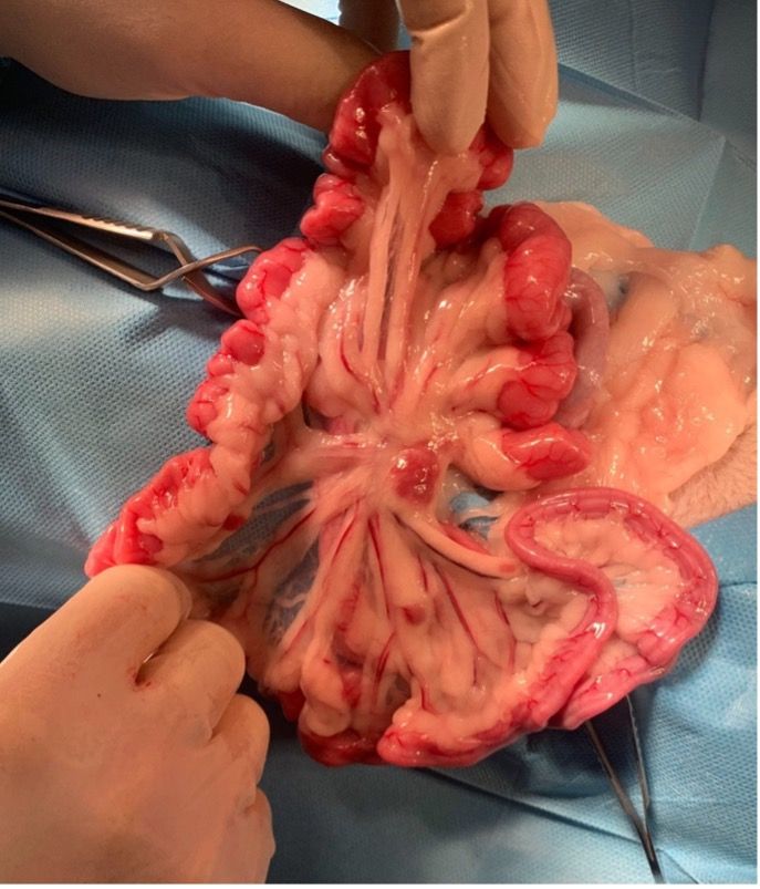 Figure 5: Plicamiento intestinal